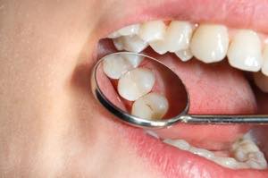 奥歯の範囲と機能