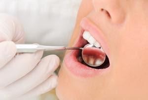 虫歯があってもセラミック矯正で歯並びの改善は可能