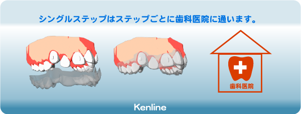 シングルステップはステップごとに歯科医院に通います。