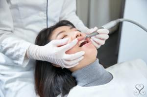 口腔内の清掃 PMTC（歯のクリーニング）