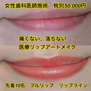 歯科医師が施術!リップアートメイクモニター募集