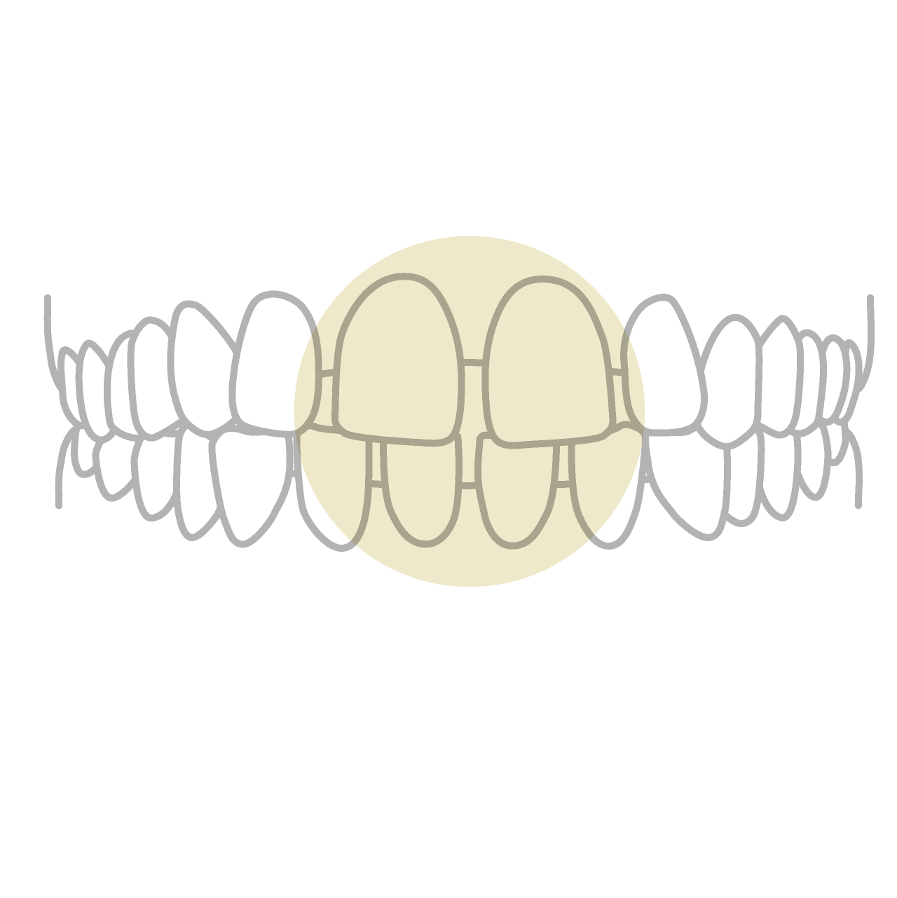前歯の空隙歯列・正中離開（すきっ歯）