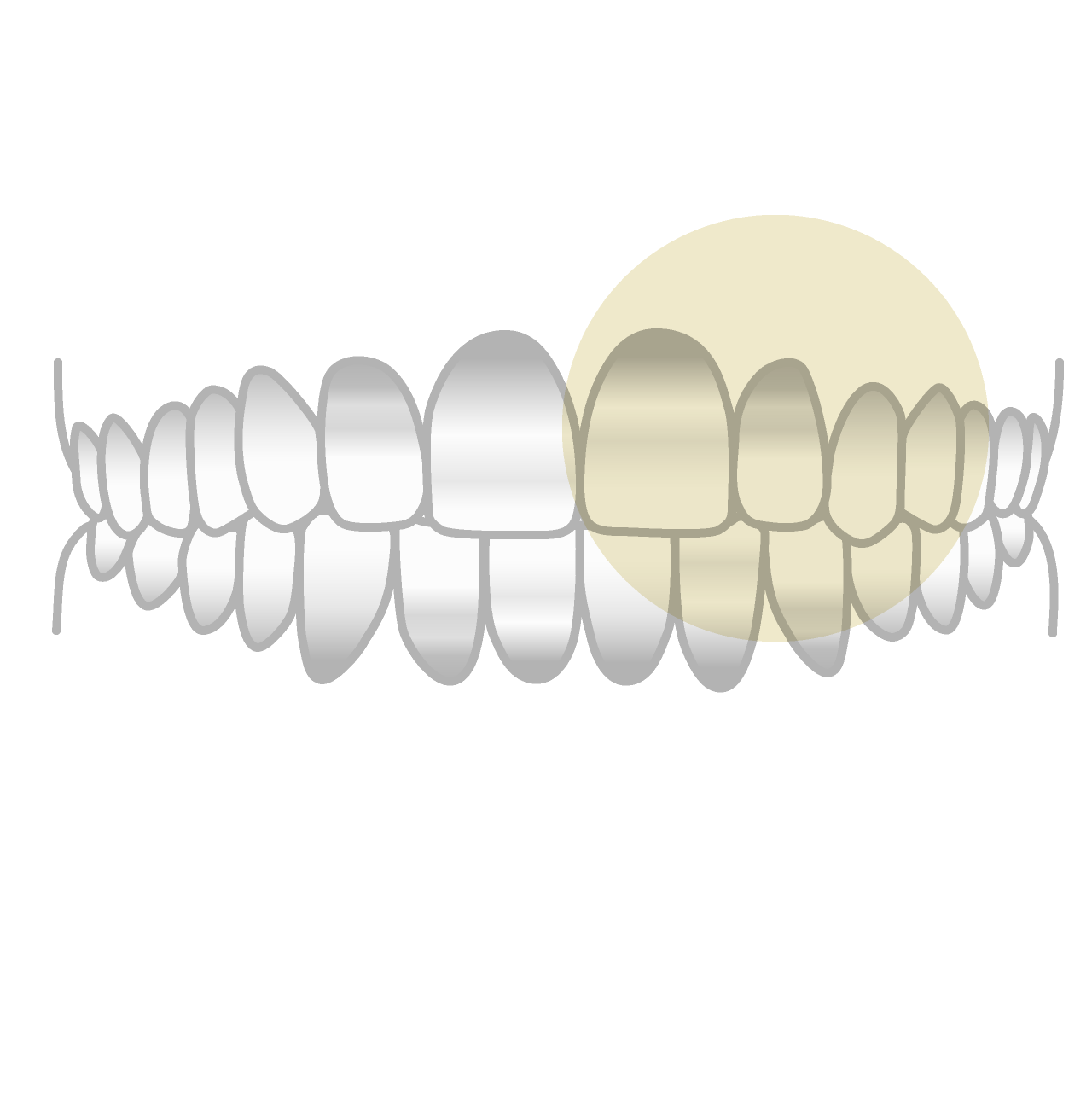 テトラサイクリン歯
